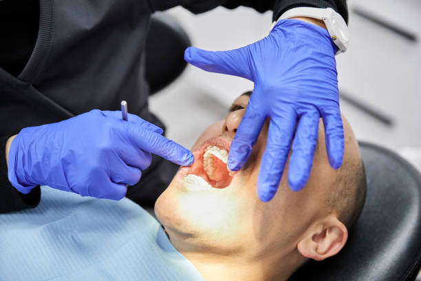 Best Emergency Wisdom Teeth Removal in South Yarmouth, MA